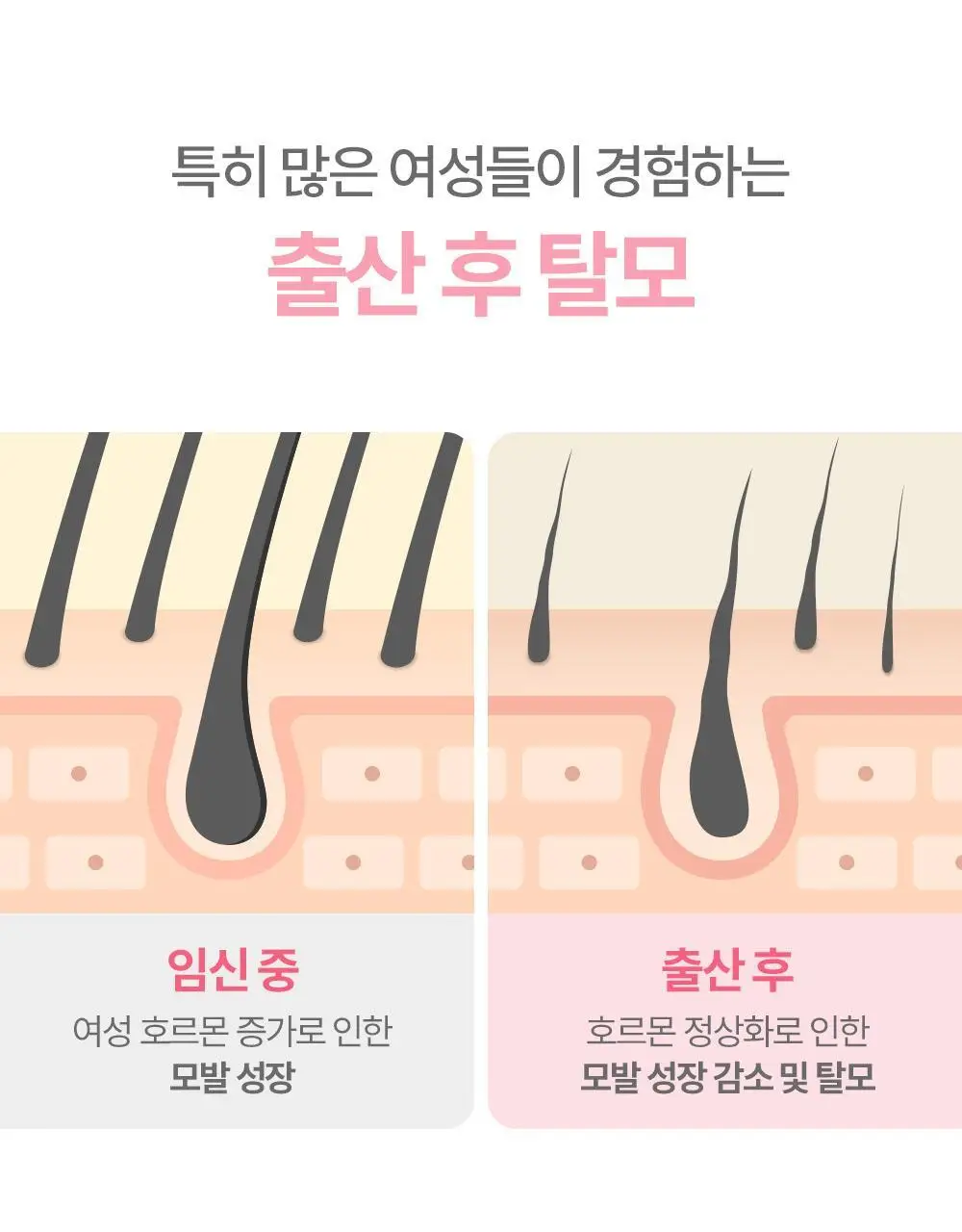 [임산부] 아토팜 매터니티 케어 스칼프 테라피 트리트먼트 220ml 상세페이지 9